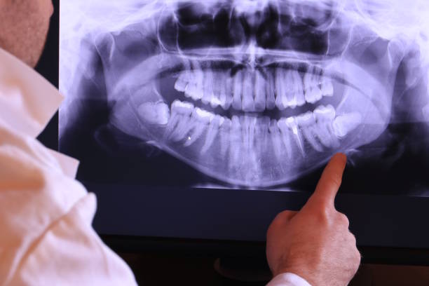 Best Emergency Treatment for Toothache in Hainesvle, IL