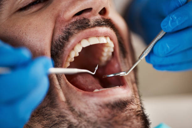 Best Same-Day Emergency Dentist in Hainesvle, IL