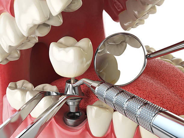 Best Emergency Dental Surgery in Hainesvle, IL