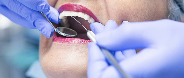 Best Walk-In Emergency Dentist in Hainesvle, IL